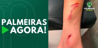 Mayke com perna machucada Palmeiras Agora